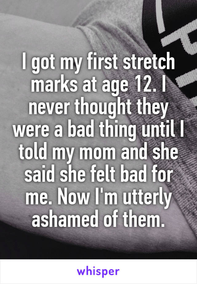 I got my first stretch marks at age 12. I never thought they were a bad thing until I told my mom and she said she felt bad for me. Now I'm utterly ashamed of them.
