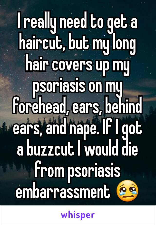 I really need to get a haircut, but my long hair covers up my psoriasis on my forehead, ears, behind ears, and nape. If I got a buzzcut I would die from psoriasis embarrassment 😢