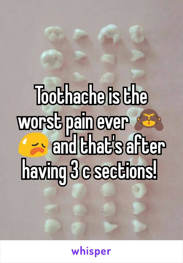Toothache is the worst pain ever 🙈😥 and that's after having 3 c sections! 
