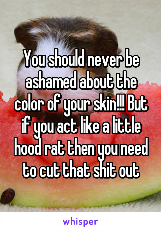 You should never be ashamed about the color of your skin!!! But if you act like a little hood rat then you need to cut that shit out