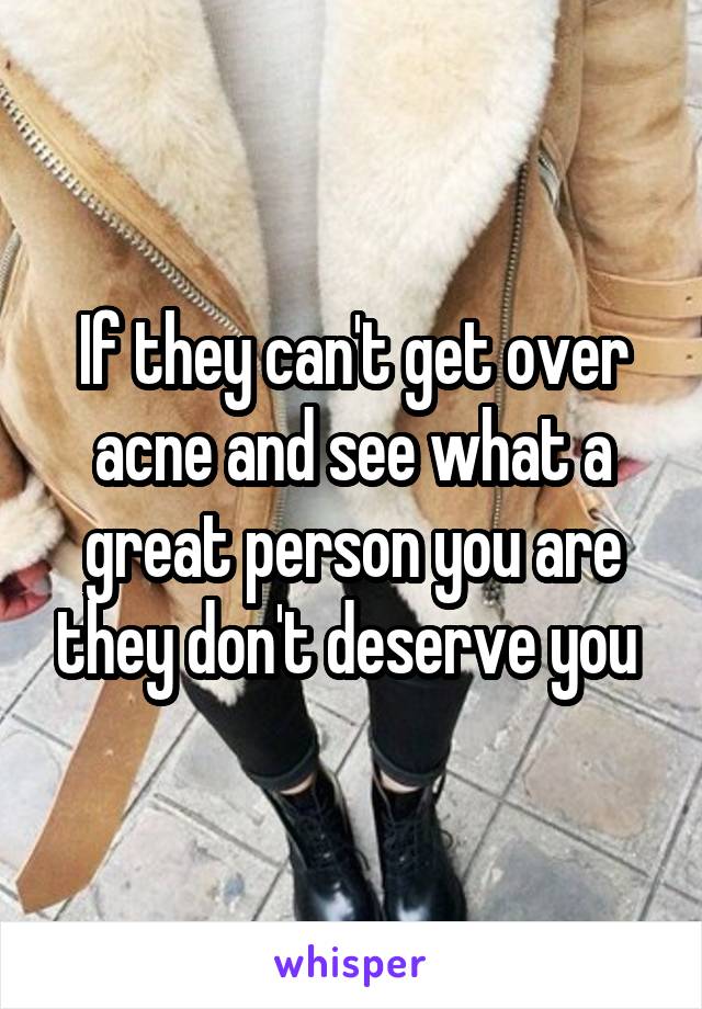 If they can't get over acne and see what a great person you are they don't deserve you 