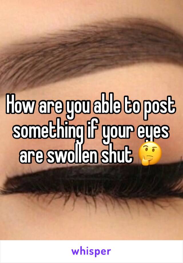 How are you able to post something if your eyes are swollen shut 🤔
