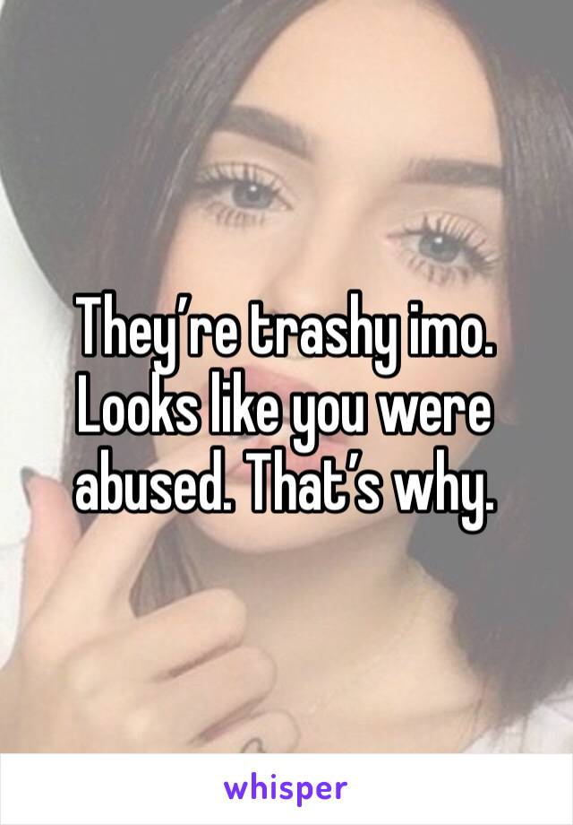 They’re trashy imo. Looks like you were abused. That’s why.