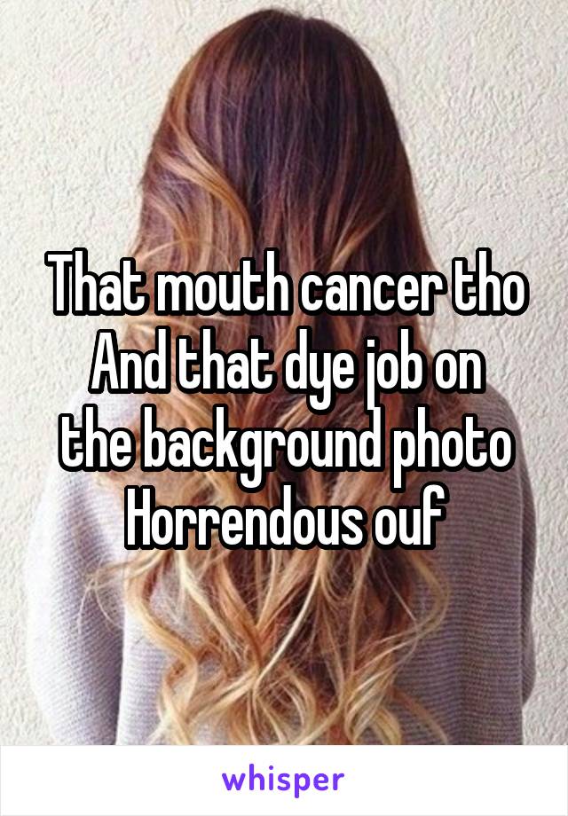 That mouth cancer tho
And that dye job on the background photo
Horrendous ouf