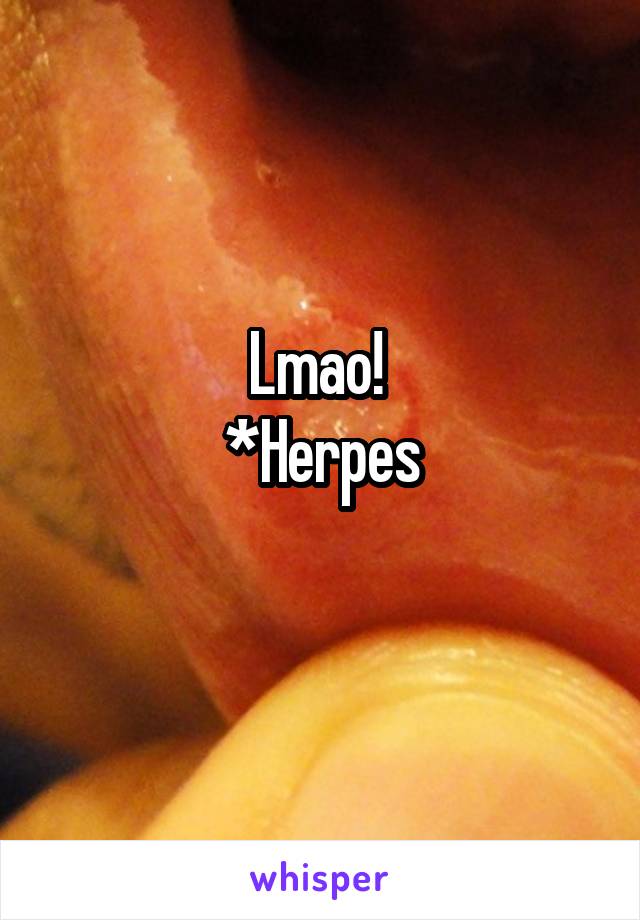 Lmao! 
*Herpes
