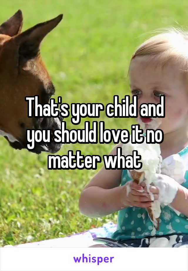 That's your child and you should love it no matter what