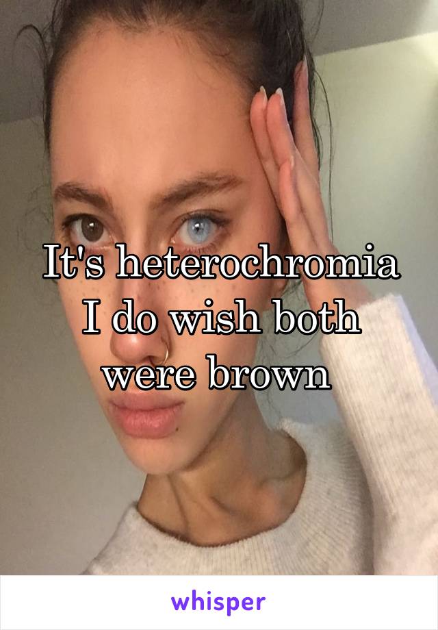 It's heterochromia I do wish both were brown 