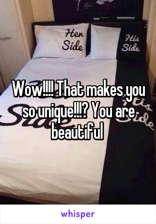 Wow!!!! That makes you so unique!!!? You are beautiful 