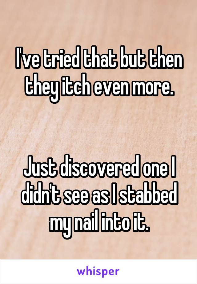 I've tried that but then they itch even more.


Just discovered one I didn't see as I stabbed my nail into it.