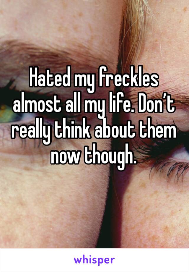 Hated my freckles almost all my life. Don’t really think about them now though. 