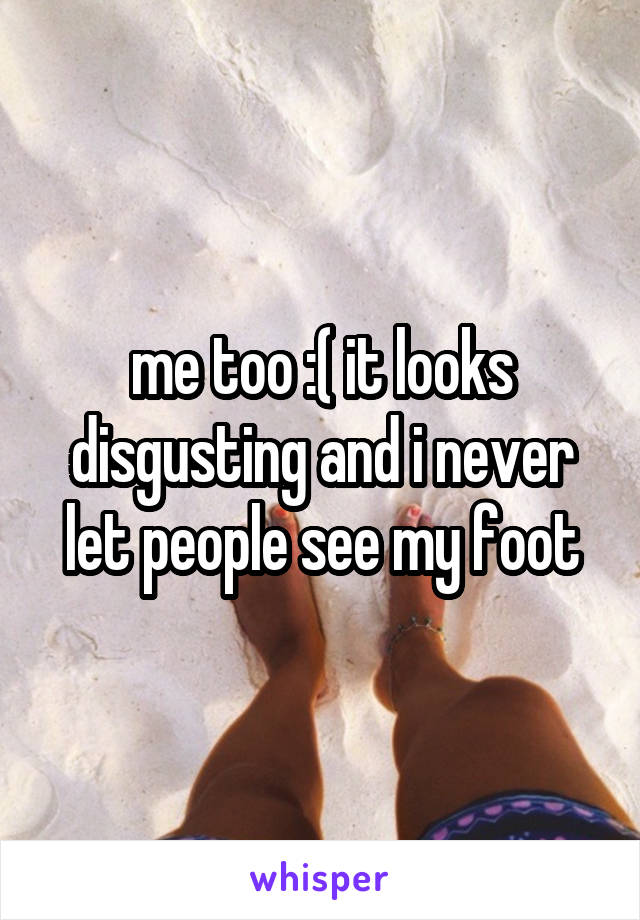 me too :( it looks disgusting and i never let people see my foot