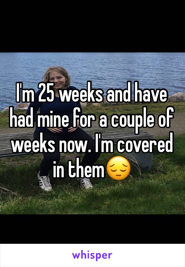 I'm 25 weeks and have had mine for a couple of weeks now. I'm covered in them😔