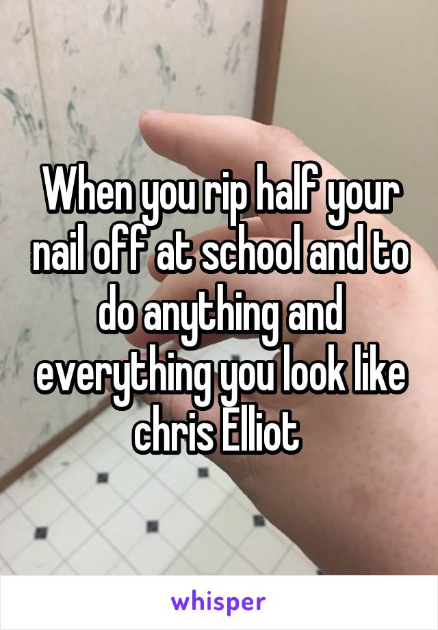 When you rip half your nail off at school and to do anything and everything you look like chris Elliot 
