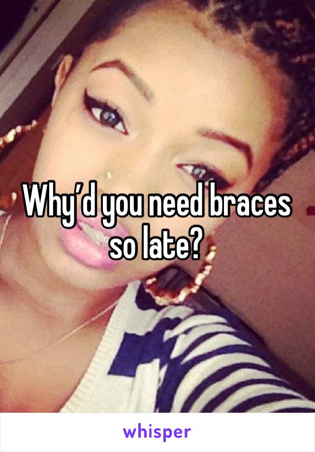 Why’d you need braces so late?