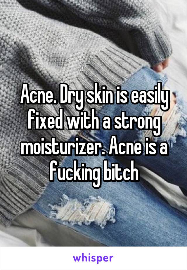 Acne. Dry skin is easily fixed with a strong moisturizer. Acne is a fucking bitch