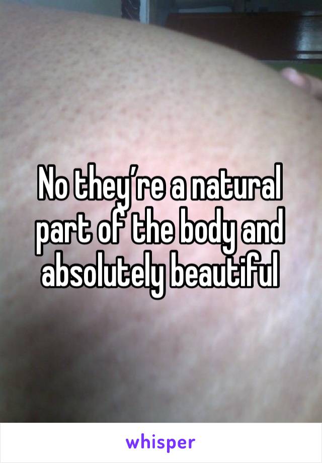 No they’re a natural part of the body and absolutely beautiful 
