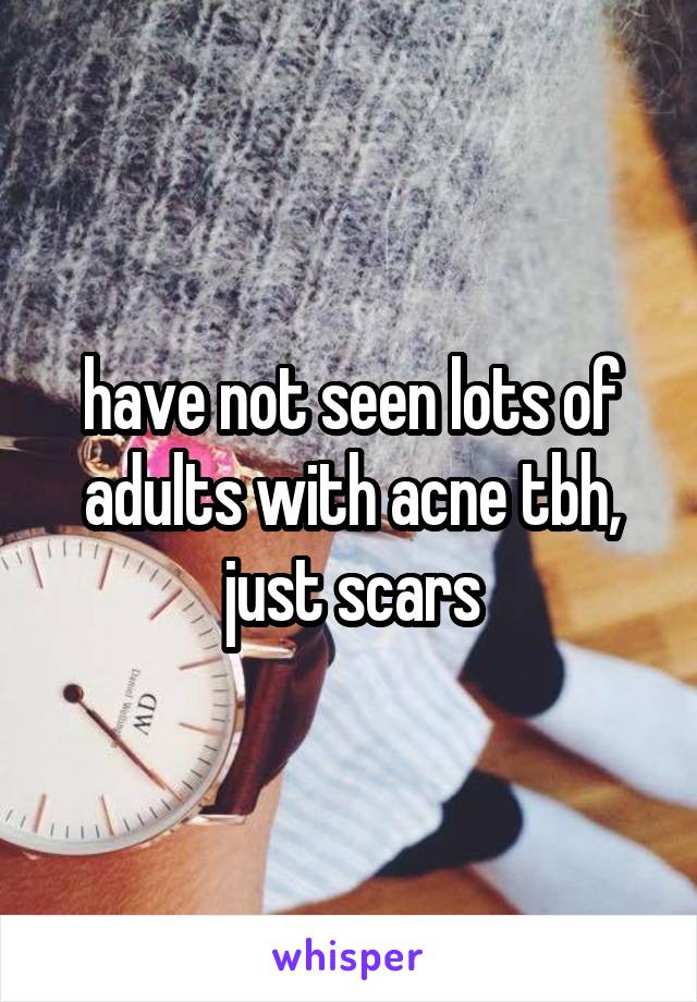 have not seen lots of adults with acne tbh, just scars