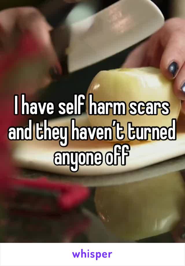 I have self harm scars and they haven’t turned anyone off