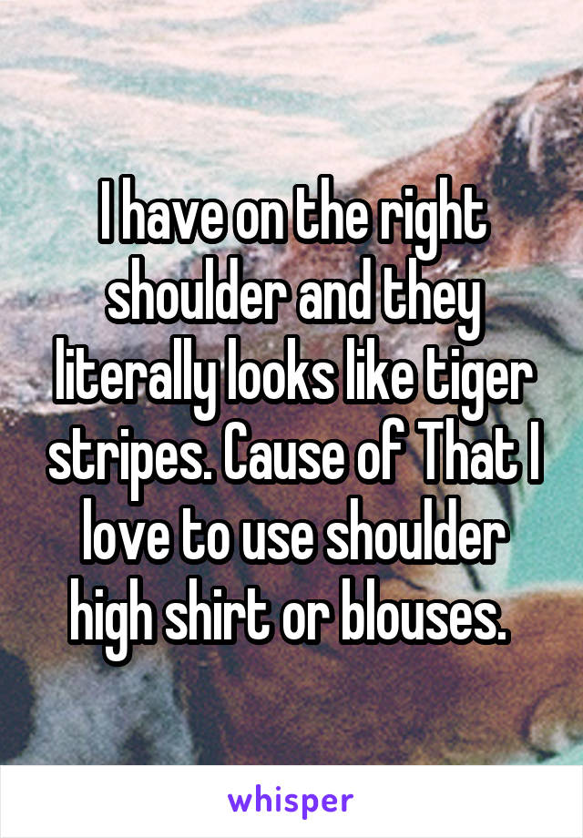 I have on the right shoulder and they literally looks like tiger stripes. Cause of That I love to use shoulder high shirt or blouses. 