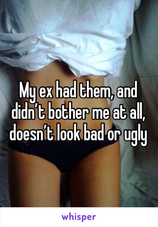 My ex had them, and didn’t bother me at all, doesn’t look bad or ugly 