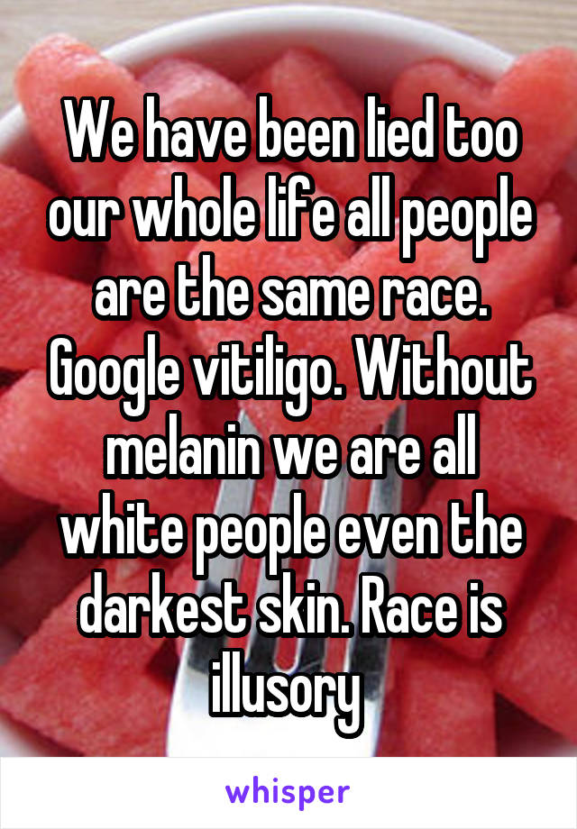We have been lied too our whole life all people are the same race. Google vitiligo. Without melanin we are all white people even the darkest skin. Race is illusory 