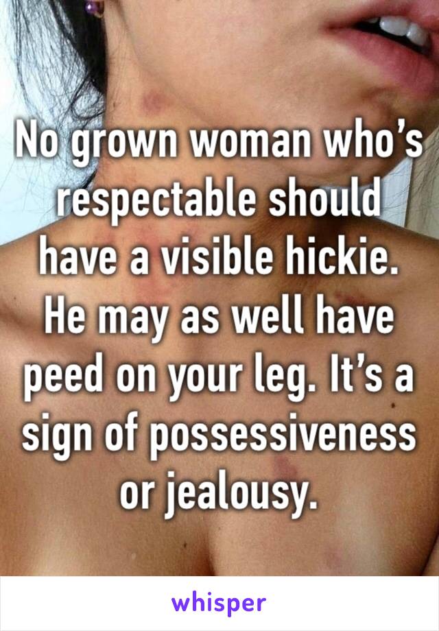 No grown woman who’s respectable should have a visible hickie. He may as well have peed on your leg. It’s a sign of possessiveness or jealousy. 