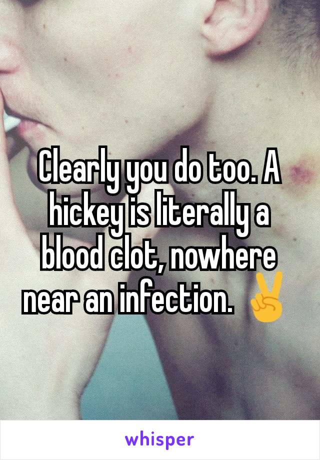 Clearly you do too. A hickey is literally a blood clot, nowhere near an infection. ✌