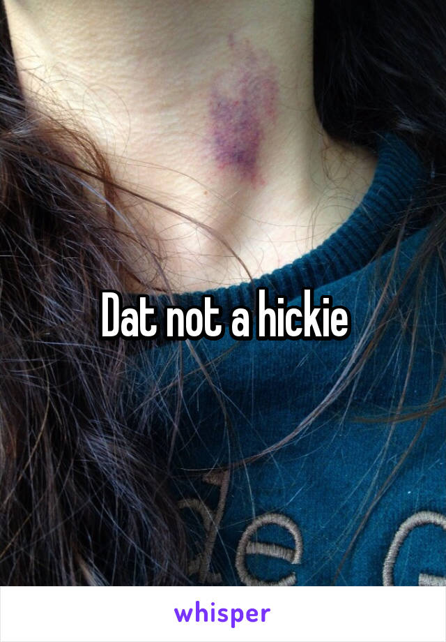 Dat not a hickie