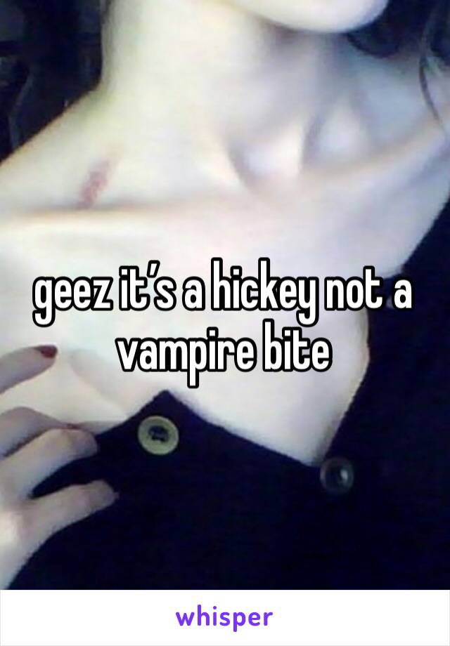 geez it’s a hickey not a vampire bite