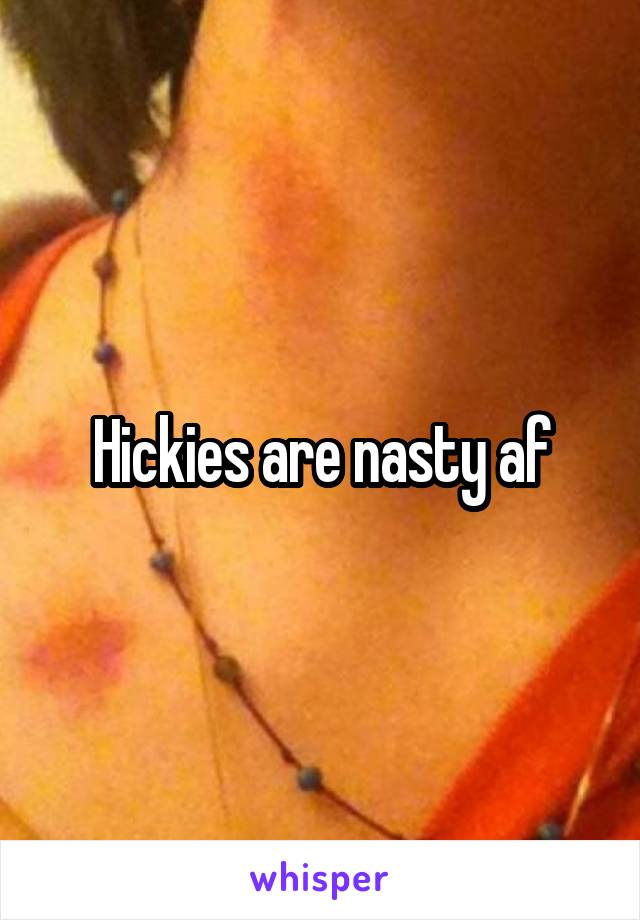 Hickies are nasty af