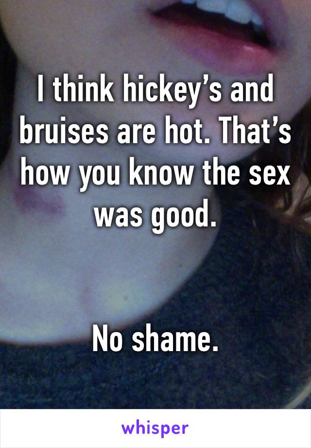 I think hickey’s and bruises are hot. That’s how you know the sex was good. 


No shame.