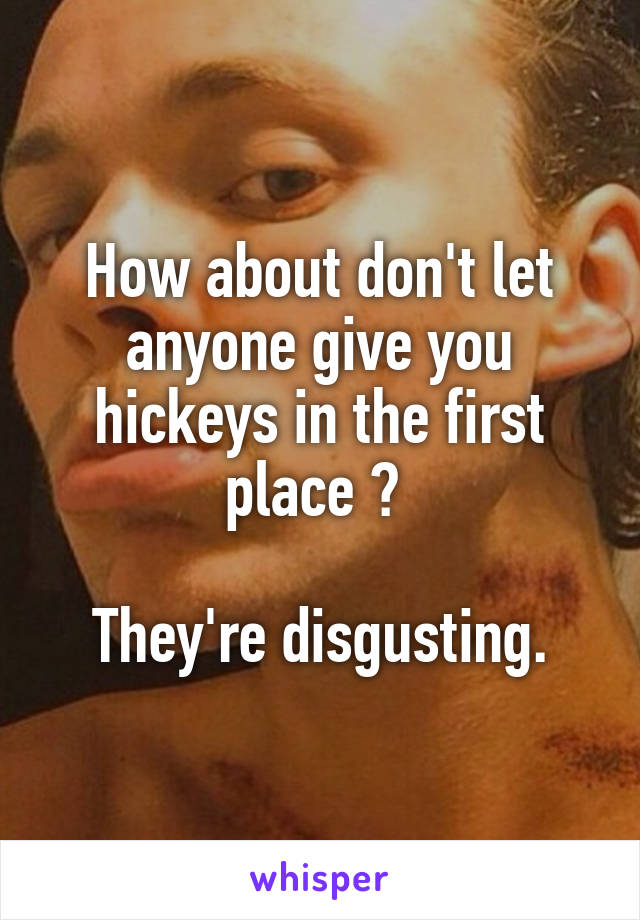 How about don't let anyone give you hickeys in the first place ? 

They're disgusting.