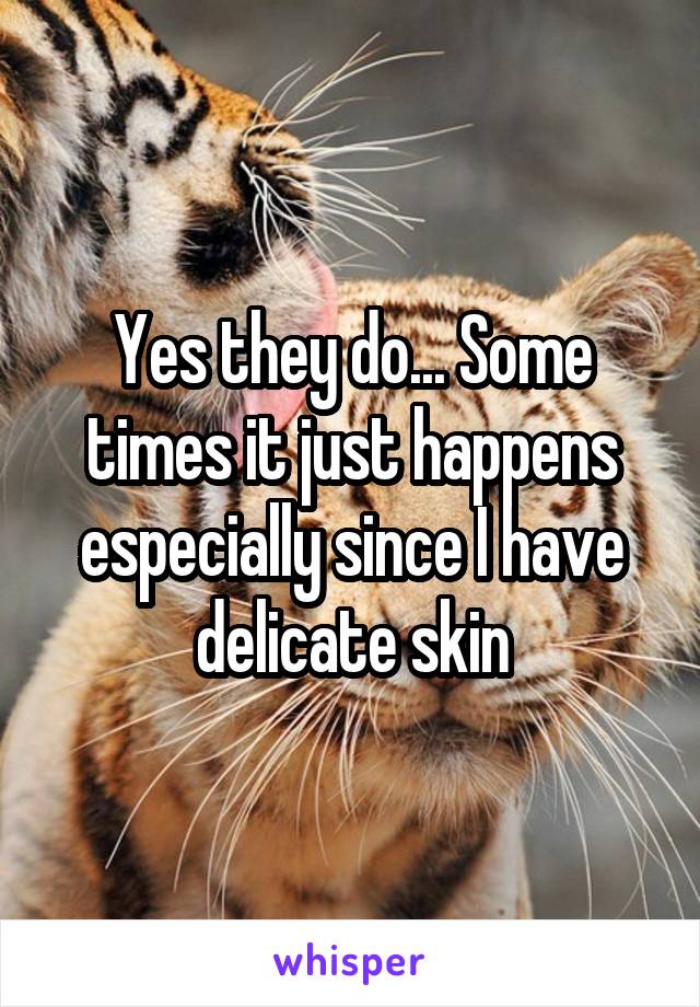 Yes they do... Some times it just happens especially since I have delicate skin