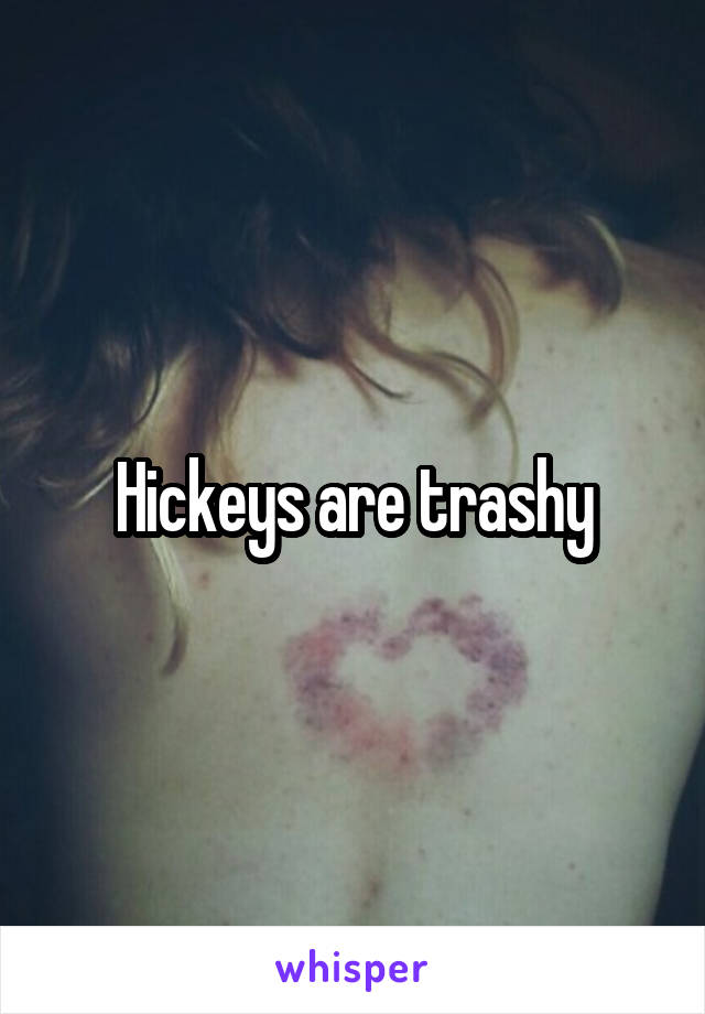 Hickeys are trashy