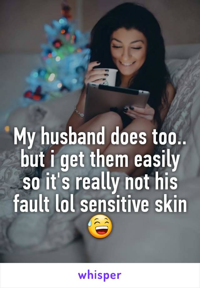 My husband does too.. but i get them easily so it's really not his fault lol sensitive skin😅