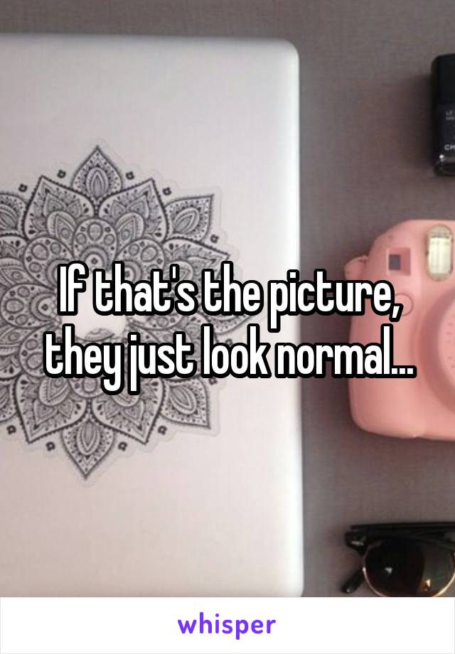 If that's the picture, they just look normal...