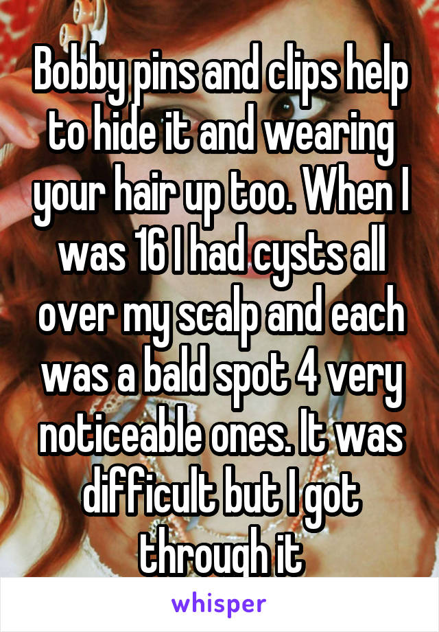 Bobby pins and clips help to hide it and wearing your hair up too. When I was 16 I had cysts all over my scalp and each was a bald spot 4 very noticeable ones. It was difficult but I got through it