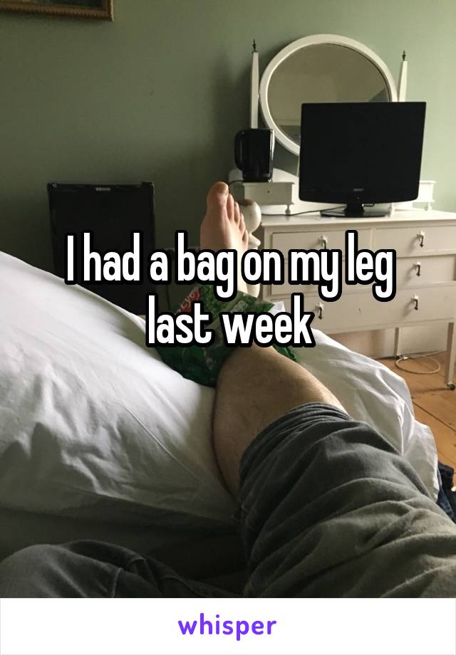 I had a bag on my leg last week
