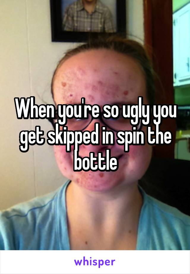 When you're so ugly you get skipped in spin the bottle