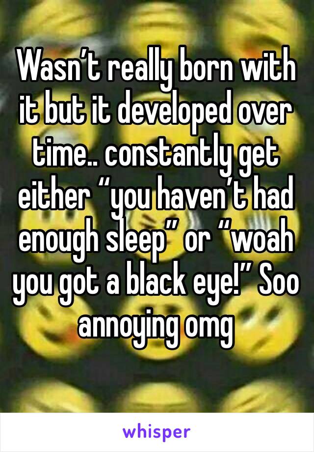 Wasn’t really born with it but it developed over time.. constantly get either “you haven’t had enough sleep” or “woah you got a black eye!” Soo annoying omg