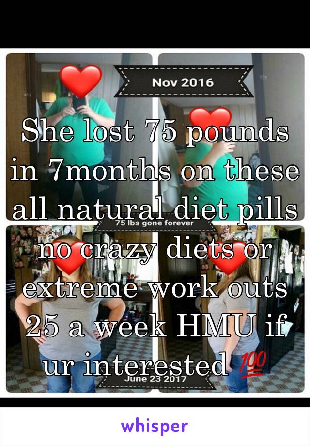 She lost 75 pounds in 7months on these all natural diet pills no crazy diets or extreme work outs 25 a week HMU if ur interested 💯