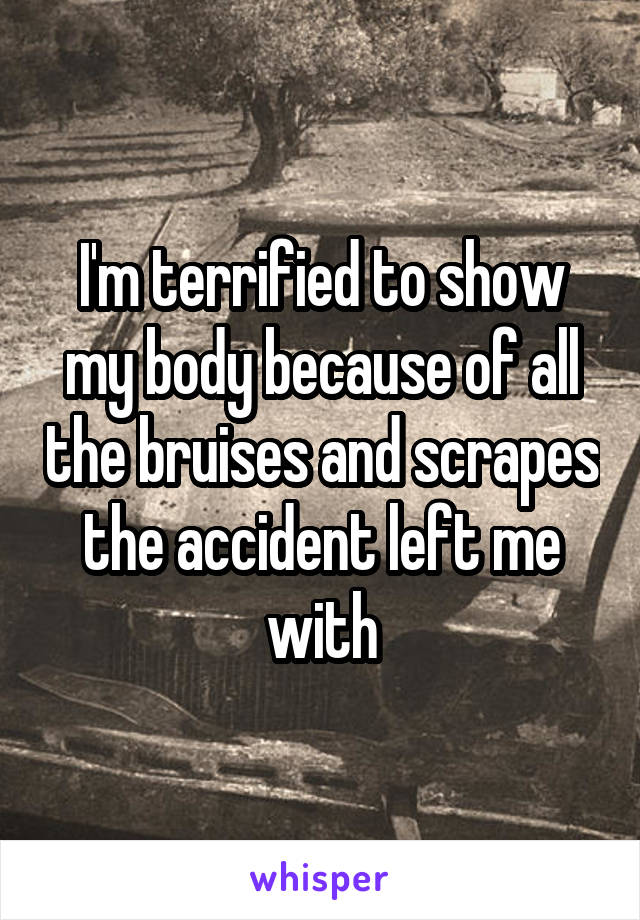 I'm terrified to show my body because of all the bruises and scrapes the accident left me with