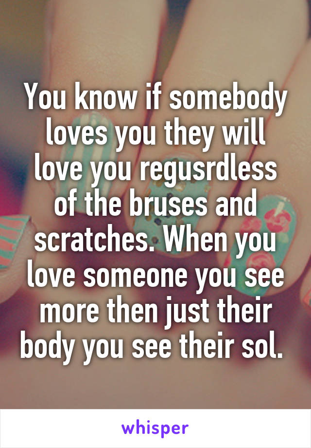 You know if somebody loves you they will love you regusrdless of the bruses and scratches. When you love someone you see more then just their body you see their sol. 