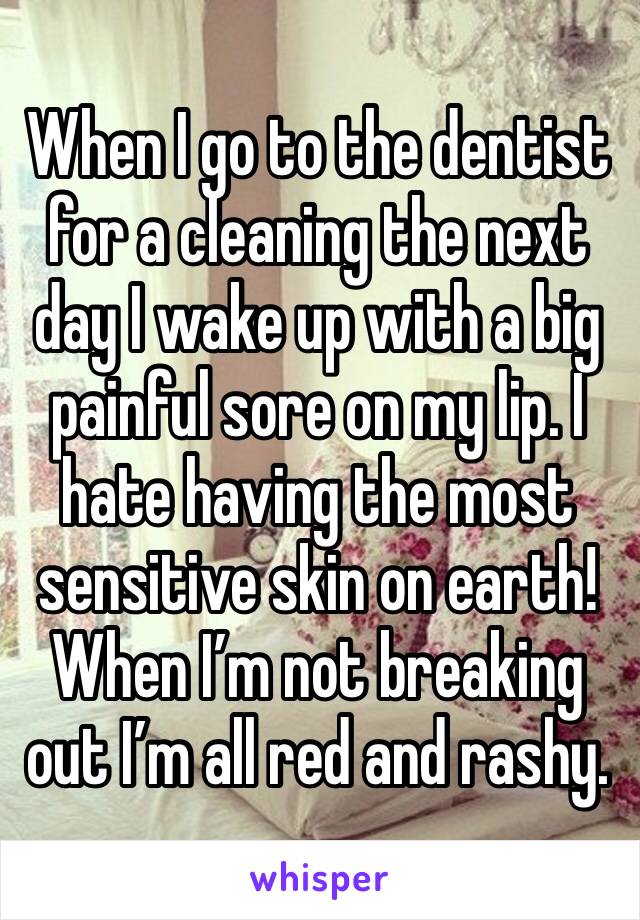 When I go to the dentist for a cleaning the next day I wake up with a big painful sore on my lip. I hate having the most sensitive skin on earth! When I’m not breaking out I’m all red and rashy. 