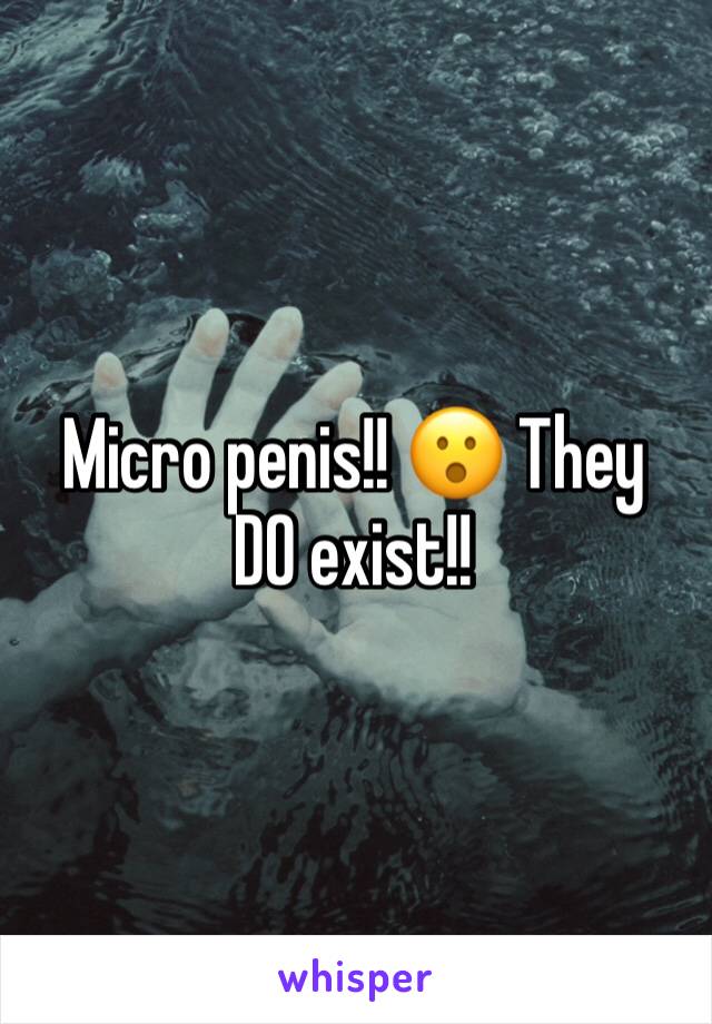 Micro penis!! 😮 They DO exist!!  