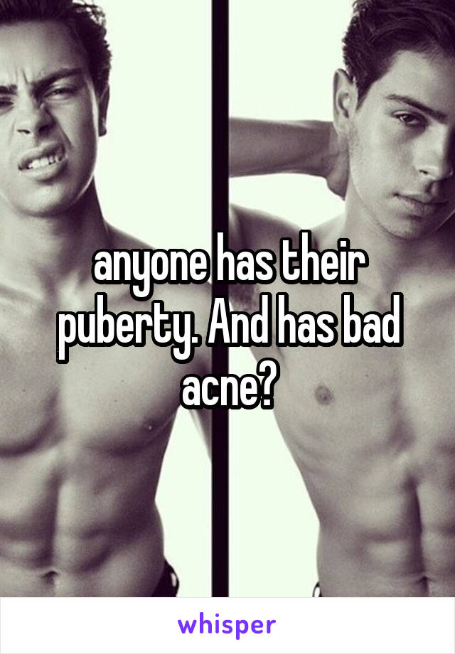 anyone has their puberty. And has bad acne?