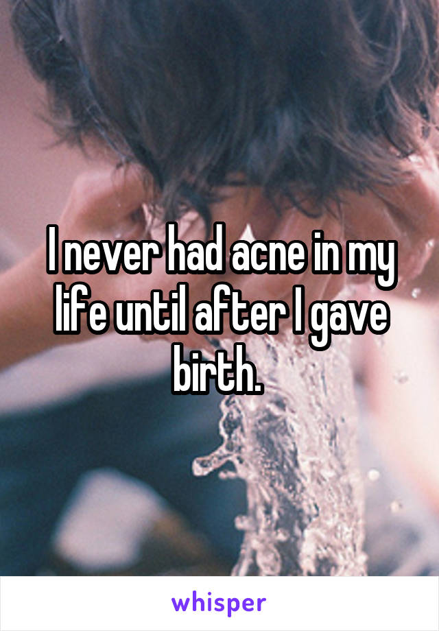 I never had acne in my life until after I gave birth. 