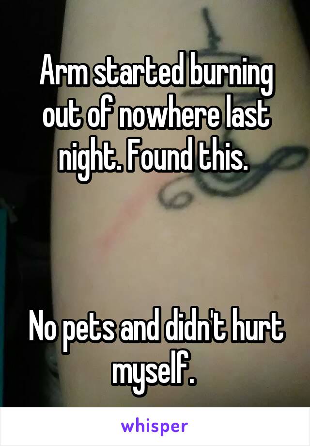 Arm started burning out of nowhere last night. Found this. 



No pets and didn't hurt myself. 