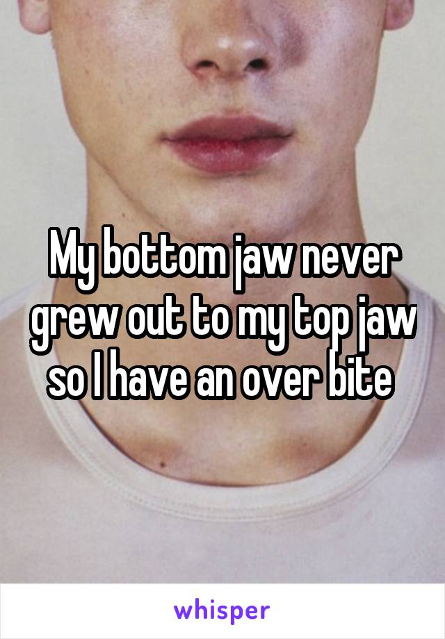 My bottom jaw never grew out to my top jaw so I have an over bite 