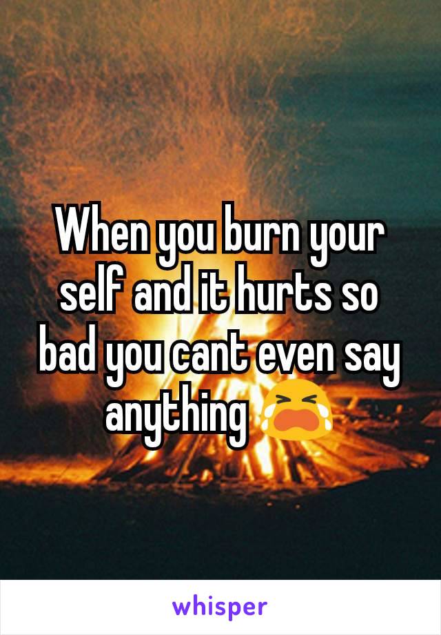 When you burn your self and it hurts so bad you cant even say anything 😭